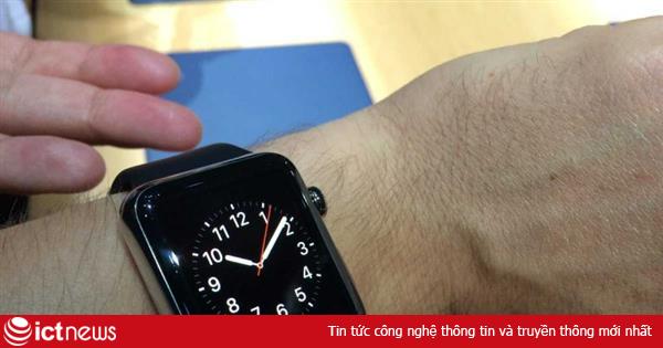 Apple Watch trông như được thiết kế bởi một sinh viên năm nhất