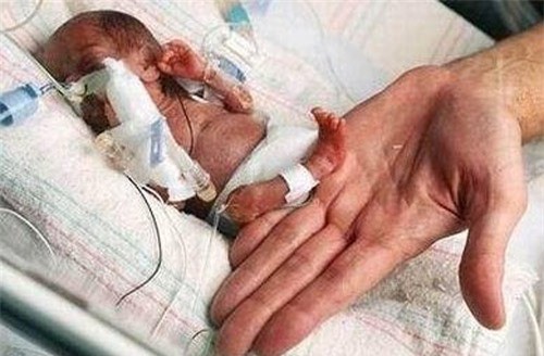 10 ky luc mang thai khien ca the gioi