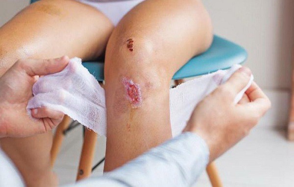 ý tưởng điên rồ