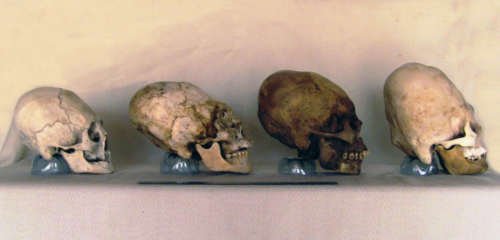 Nhung hop so bi an nhat tung duoc phat hien