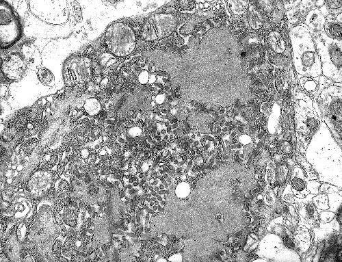 diem danh nhung virus dang so tren trai dat hinh 2