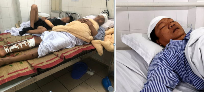 Khởi tố vụ án truy sát dã man 3 ngư dân trên biển -0