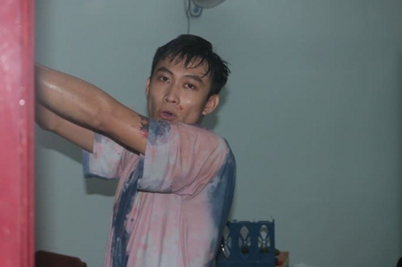 Đối tượng “ngáo đá” dùng dao đâm bị thương 3 người -0