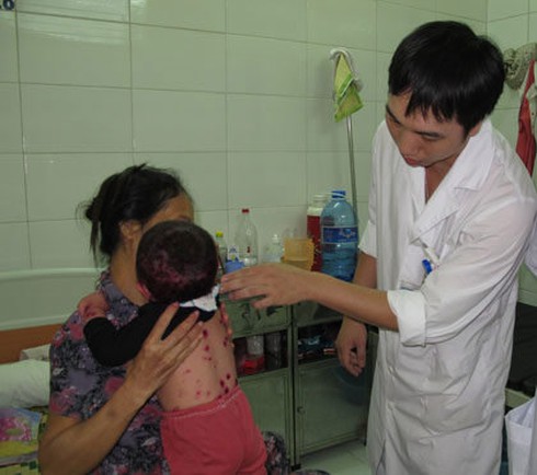 TP.HCM: Xuất hiện nhiều chùm ca thủy đậu tại trường học - ảnh 1