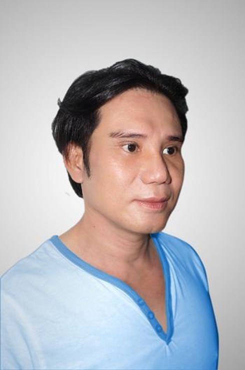 Hy vọng cho người rụng tóc - ảnh 1