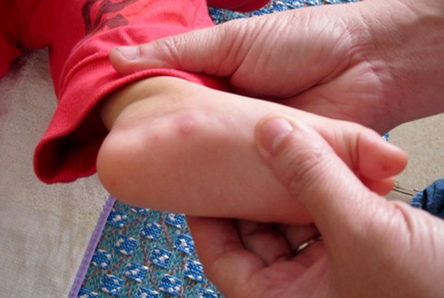 Trẻ bị tay chân miệng kiêng ăn gì? - ảnh 1