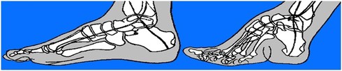 Bó chân - tập tục và chuẩn mực hà khắc, đau đớn nhất trong lịch sử - ảnh 4