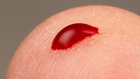 Phương pháp thử máu mới giúp nhận biết các loại virus đã và đang mắc phải - ảnh 1