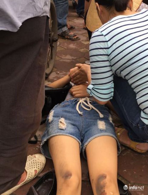 Đang đi bộ, thiếu nữ bất ngờ ngã xuống đường nằm bất tỉnh - ảnh 1