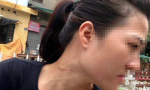 Cô gái kể phút thoát chết khỏi tay thầy bói nhờ... mái tóc giả - ảnh 1