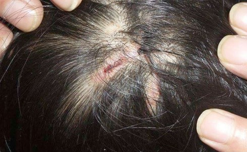 Vụ bé gái bị nhốt trong chùa, chằng chịt vết thương: Sư thầy nói gì? - ảnh 1