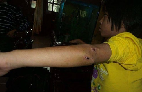 Vụ bé gái bị nhốt trong chùa, chằng chịt vết thương: Sư thầy nói gì? - ảnh 2