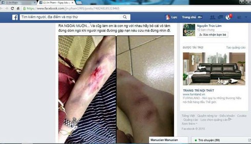 Thực hư chuyện cô gái bị đánh, cướp trong đêm ở Thủ đô - ảnh 2