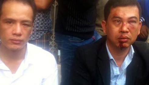 Vụ 2 luật sư bị đánh: Cơ quan điều tra khởi tố 7 bị can - ảnh 1