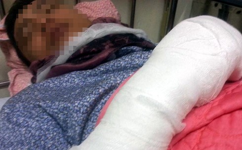 Nam thanh niên bị côn đồ chém đứt hai ngón tay - ảnh 3