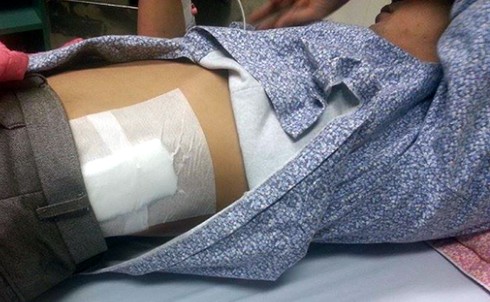 Nam thanh niên bị côn đồ chém đứt hai ngón tay - ảnh 2