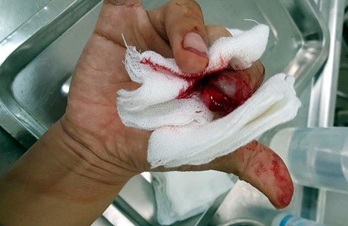 Vụ Nhà báo bị 3 đối tượng đánh trọng thương: Công an khẩn trương vào cuộc - ảnh 3