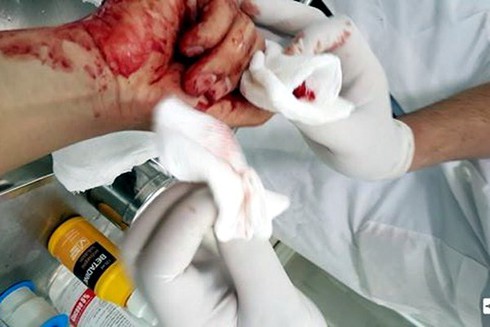 Côn đồ đánh nhà báo Đỗ Doãn Hoàng lọt vào camera ở hiện trường - ảnh 2