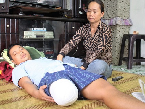 Bác sĩ cưa 1/3 chân bệnh nhân có phải chịu trách nhiệm hình sự? - ảnh 2