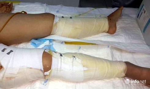 Nữ nạn nhân vụ sập nhà ở Cửa Bắc không phải đối mặt với nguy cơ bị cắt chân - ảnh 2