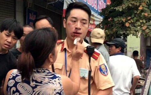 Nam thanh niên đấm CSGT gãy 2 răng cửa bị khởi tố - ảnh 2