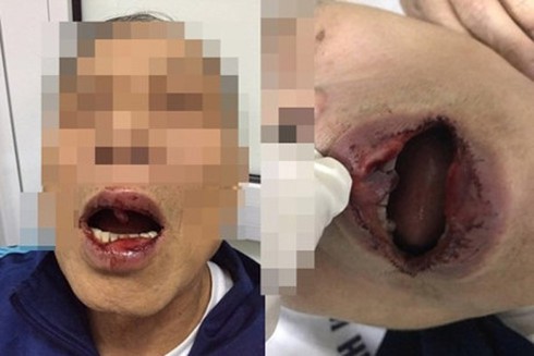 Cách chức Phó Giám đốc hành hung tiến sĩ 76 tuổi - ảnh 1