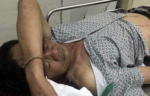 Xác minh làm rõ vụ việc một cựu chiến binh bị đánh phải nhập viện - ảnh 1