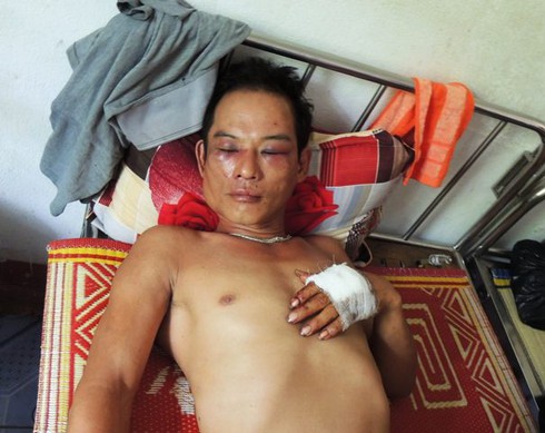 Tài xế bất ngờ bị nhóm người lạ mặt chặn đánh trọng thương - ảnh 1