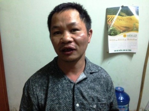 Một cán bộ kiểm lâm bị lâm tặc đánh nhập viện - ảnh 1