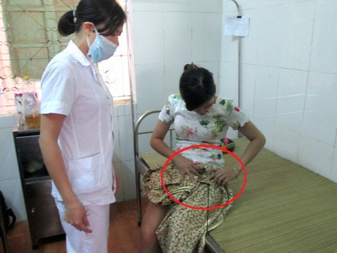 Nghệ An: Vô cớ dùng nỏ bắn liên tiếp vào người đi đường - ảnh 3