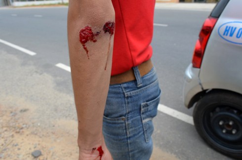 Vụ 4 phóng viên bị đánh: