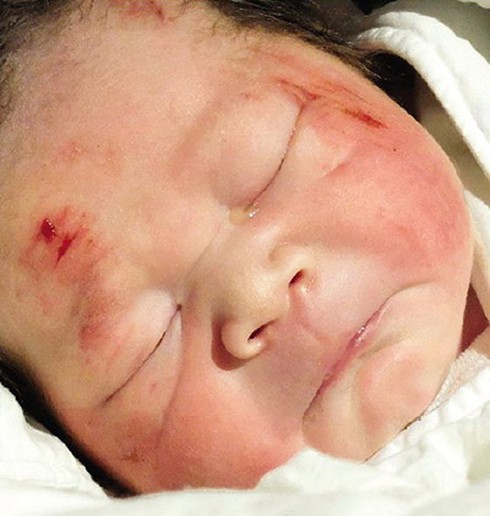 Xúc động bà mẹ bị tai nạn vẫn cố đẻ con ngoài đường - ảnh 1