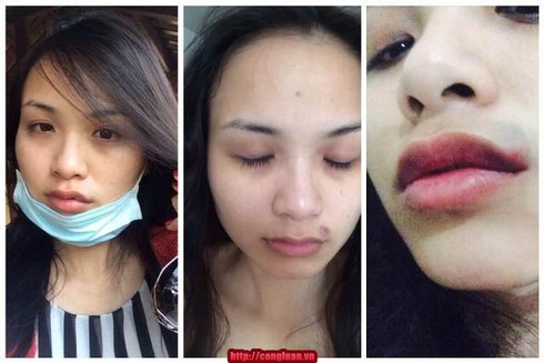 Hoa hậu Diễm Hương đưa bằng chứng mình bị chồng cũ hành hạ - ảnh 1