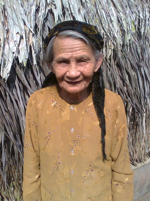 Cụ bà 82 tuổi bị ong đốt hơn 100 nốt vẫn sống - ảnh 1