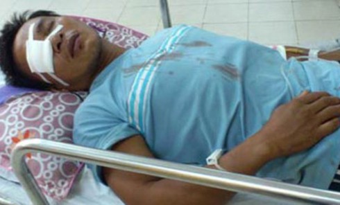 Đã xác định được các đối tượng xả súng vào ngư dân sáng 9/7 - ảnh 2