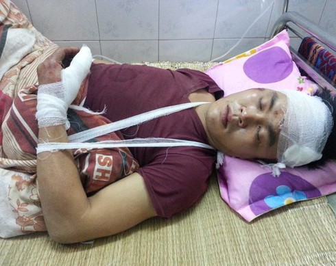 Đang đi bộ phải nhập viện vì gặp “xe điên” - ảnh 1