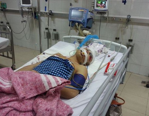 Đang đi bộ phải nhập viện vì gặp “xe điên” - ảnh 2