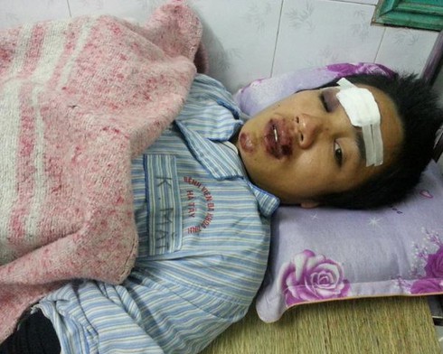 Đang đi bộ phải nhập viện vì gặp “xe điên” - ảnh 3