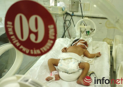 Mẹ ung thư nguy kịch, mổ bắt thai cứu bé gái 34 tuần tuổi - ảnh 2