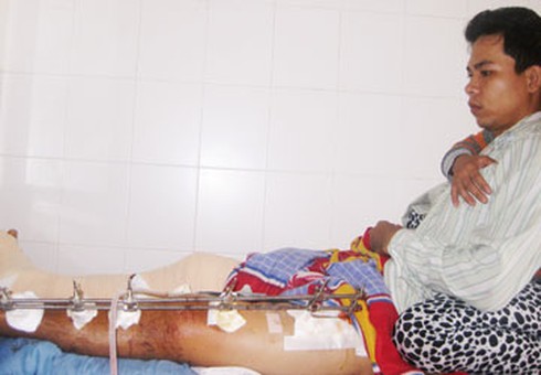 Một thanh niên bị bắn bảy phát đạn - ảnh 1