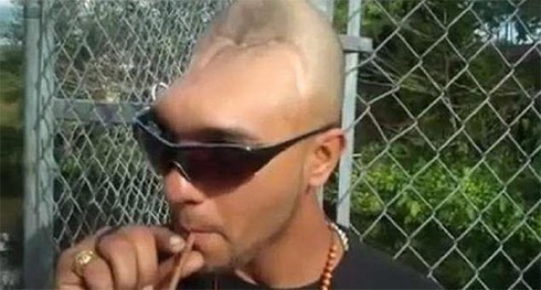 Những 'quái nhân' đầu lõm, móp, mất một nửa