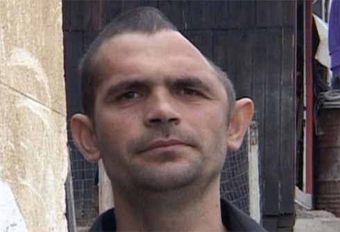 Những 'quái nhân' đầu lõm, móp, mất một nửa