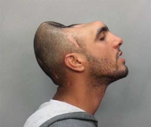 Những 'quái nhân' đầu lõm, móp, mất một nửa