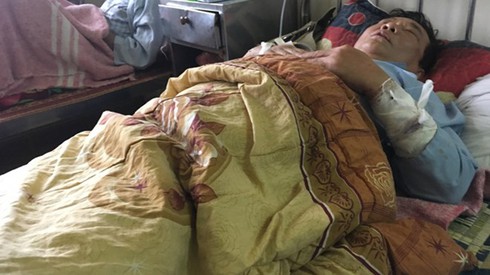 Trạm trưởng y tế bị chồng nhân viên chém trọng thương - ảnh 1