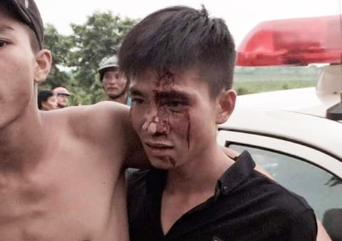 Đắk Lắk: Làm rõ vụ việc nam thanh niên chảy máu sau mâu thuẫn với công an - ảnh 1