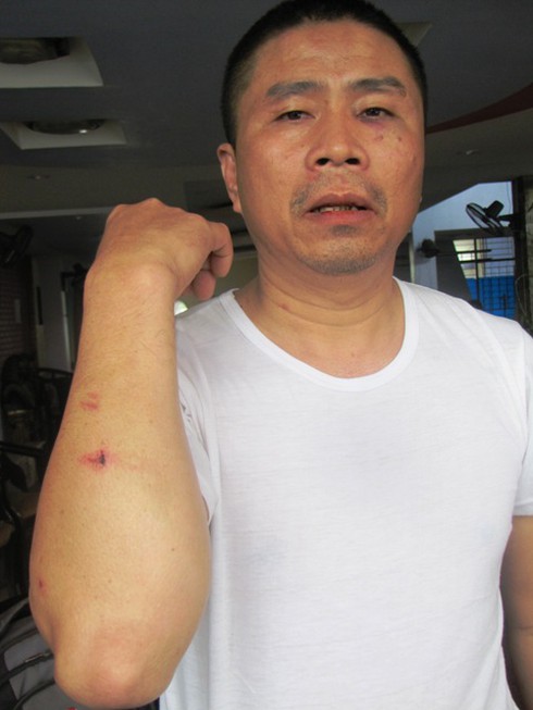 Nhóm côn đồ chặn xe khách, đánh tài xế để “dằn mặt” - ảnh 2