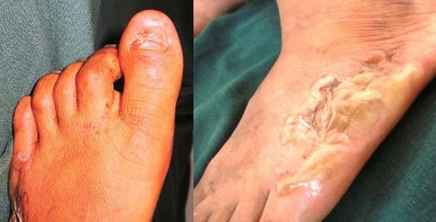 Khởi tố 3 đối tượng vụ tra tấn phụ nữ vì nghi ăn cắp - ảnh 2