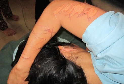 Khởi tố 3 đối tượng vụ tra tấn phụ nữ vì nghi ăn cắp - ảnh 1