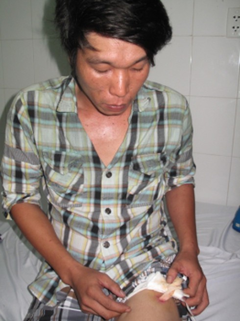 Công an viên bắn, đánh