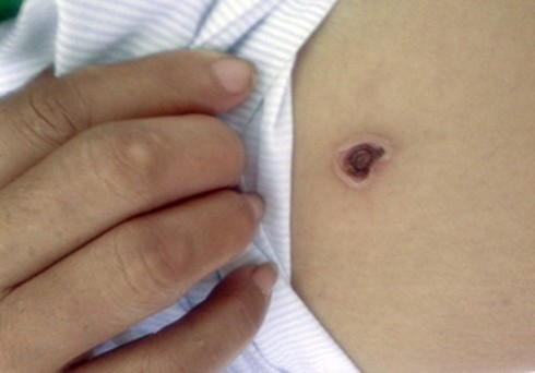 Con mò cắn: chớ xem thường! - ảnh 1